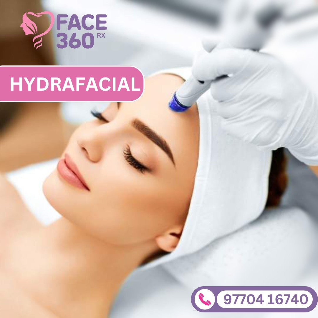 "Professional Hydrafacial treatment at Face 360 RX clinic, enhancing skin hydration and radiance."