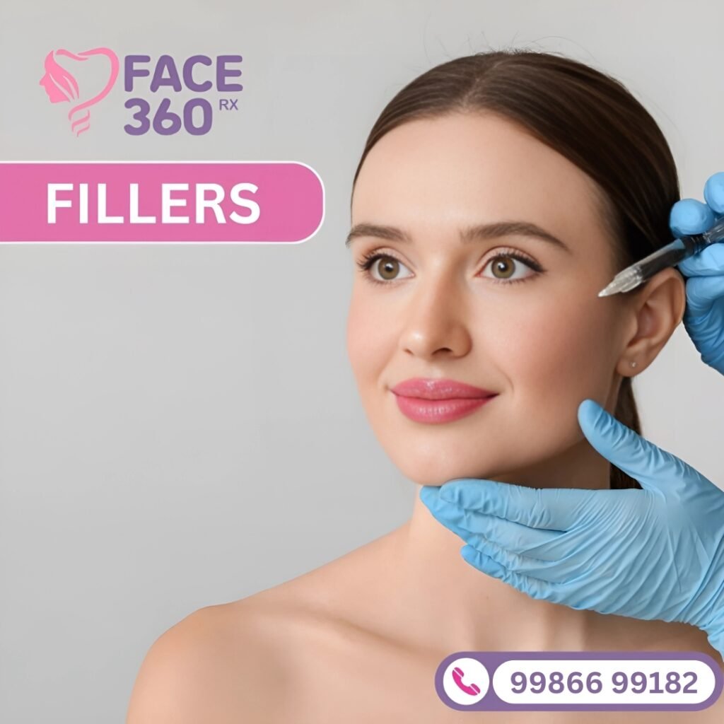 A smiling woman with fair skin having markings made on her face for dermal filler treatment, promoting Fillers by FACE 360 RX.