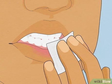 "Illustration showing the proper method to treat a cut lip using a tissue for care and hygiene."