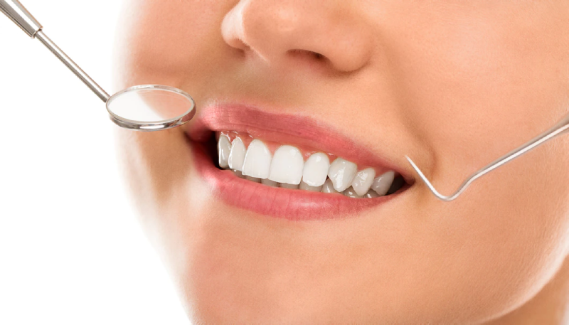 A close-up photo of a woman's smiling mouth showing her white teeth and pink gums, with a dental mirror and a dental probe positioned near her teeth, illustrating a dental check-up.