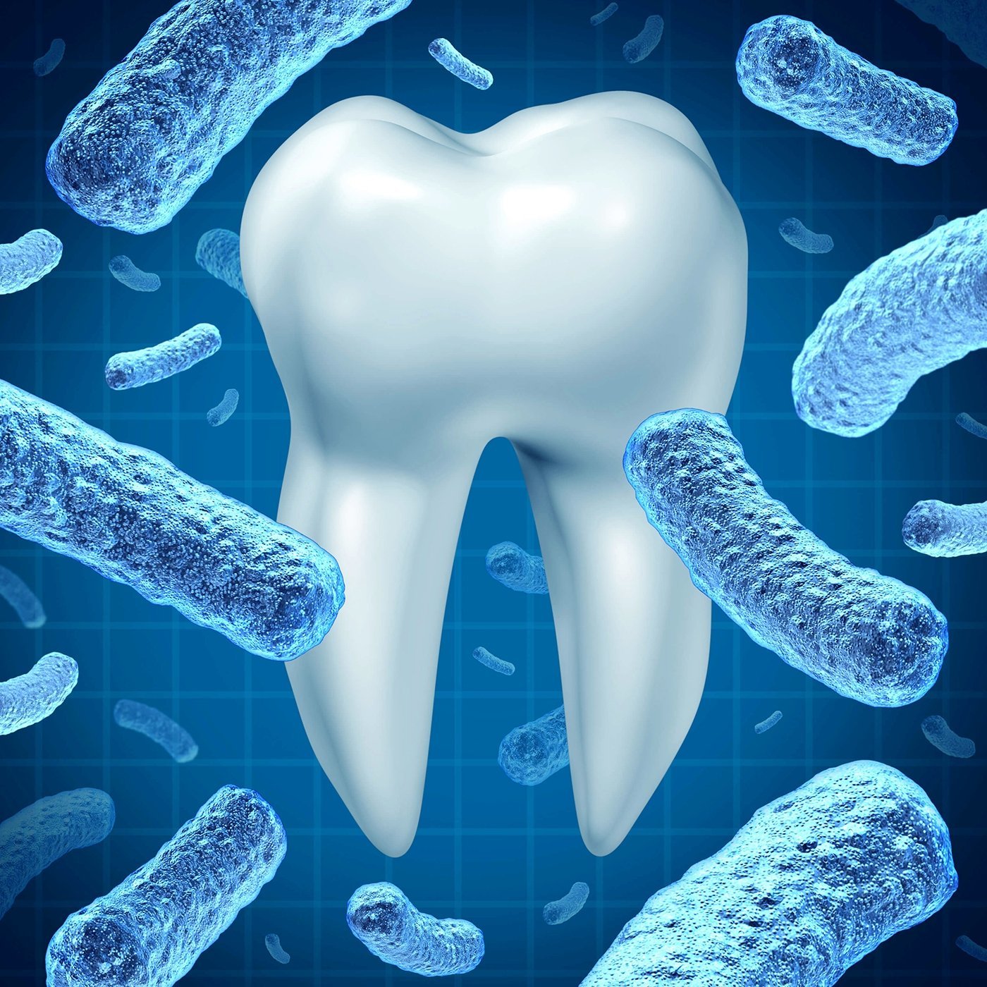 A large, white molar tooth surrounded by numerous blue, rod-shaped bacteria against a blue, grid-like background.