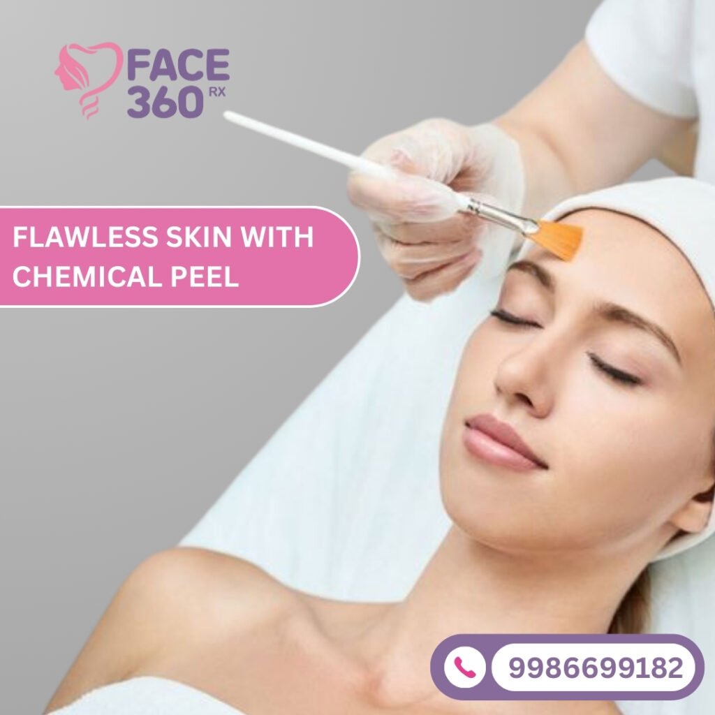 A woman with fair skin receiving a chemical peel treatment on her forehead with a brush, promoting "Flawless Skin with Chemical Peel" by FACE 360 RX.